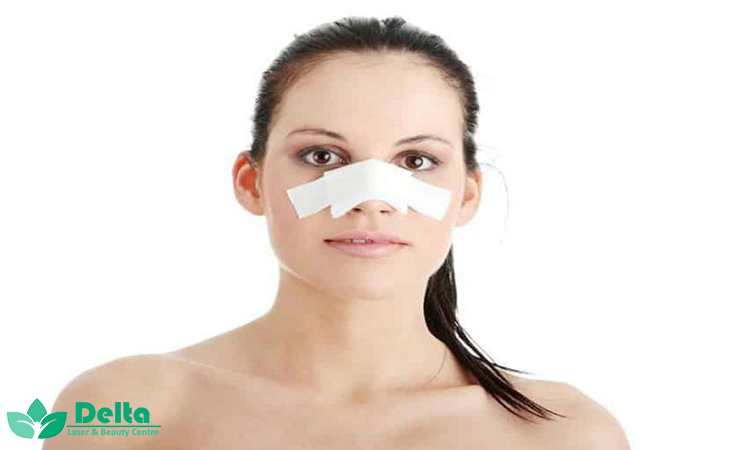 بهترین روش برای از بین بردن جای بخیه عمل بینی