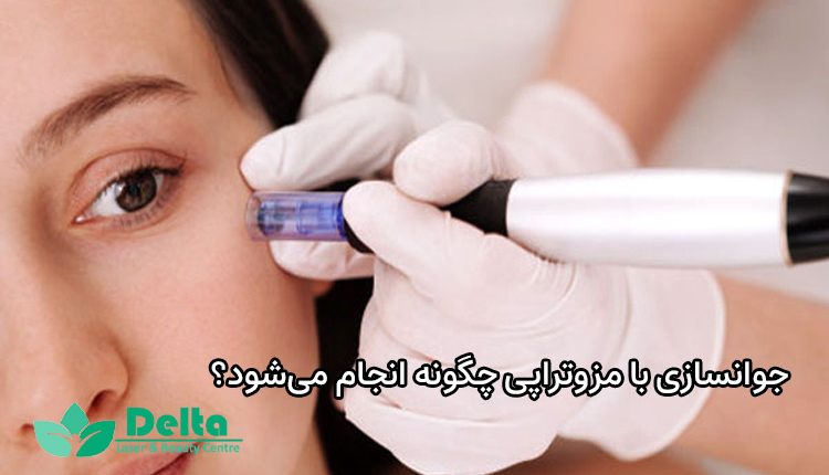 جوانسازی با مزوتراپی چگونه انجام می‌‌شود؟