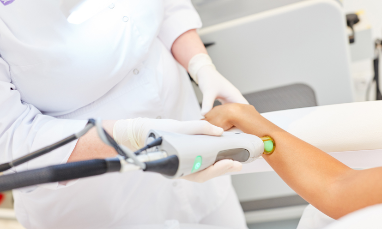 علل تیرگی تیرگی پوست پس از لیزر