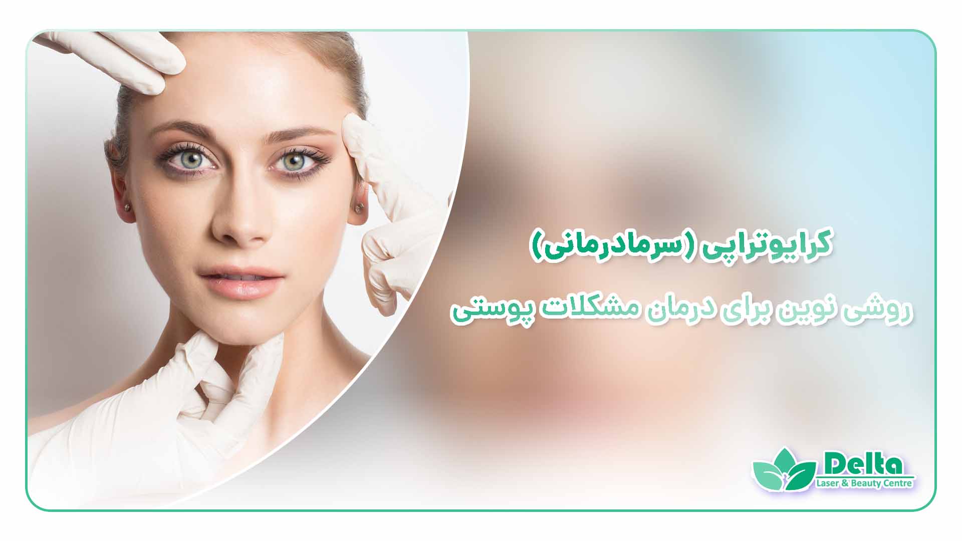 کرایوتراپی (سرمادرمانی) روشی نوین برای درمان مشکلات پوستی