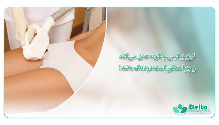 درد لیزر بیکینی