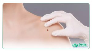 تصویری از زنی در حال خالبرداری از روی کتف خود