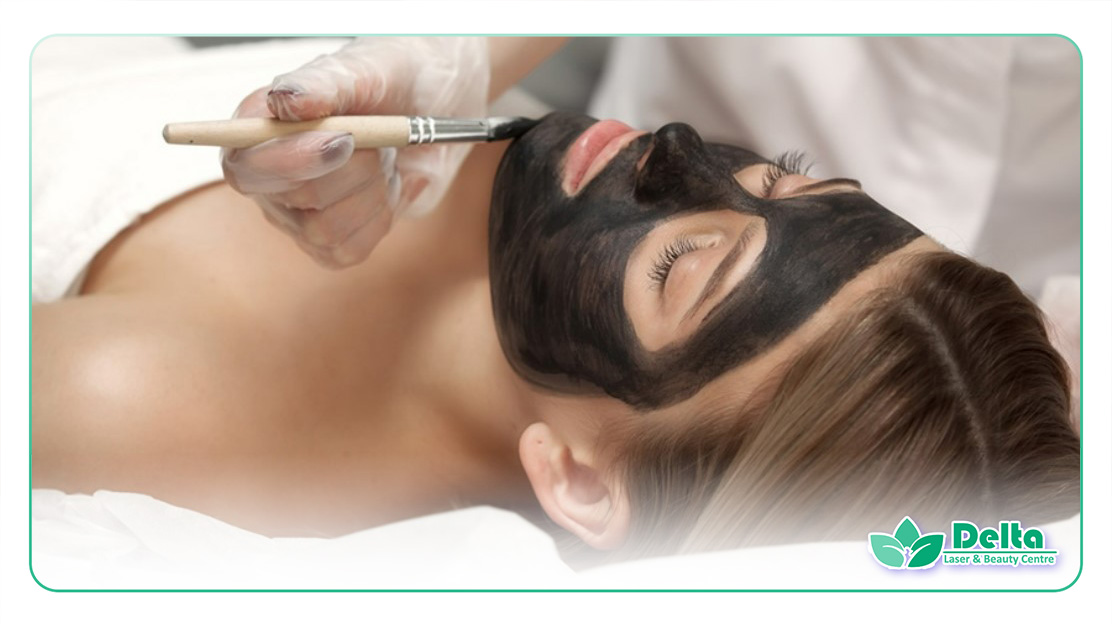 تصویری از زنی زیبا در حال کربن پیلینگ کردن ضورت خود