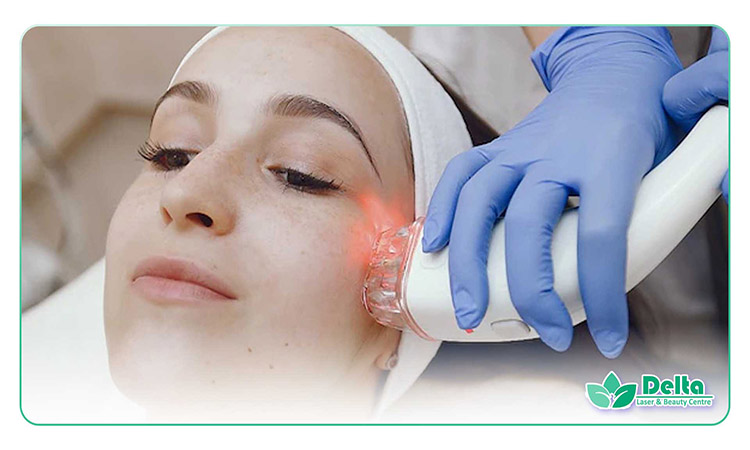 آیا لیزر موهای سفید باعث حذف آنها میشود؟