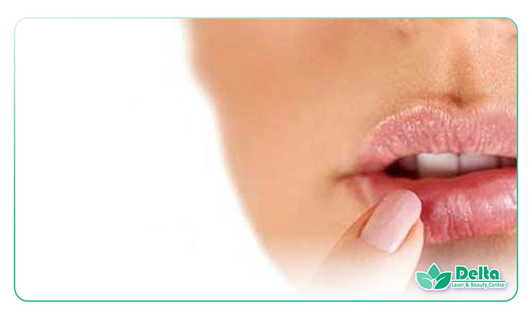 تبخال بعد از تزریق ژل لب | غلل و درمان
