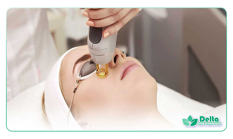 آیا لیزر موهای زائد برای همه مناسب است؟