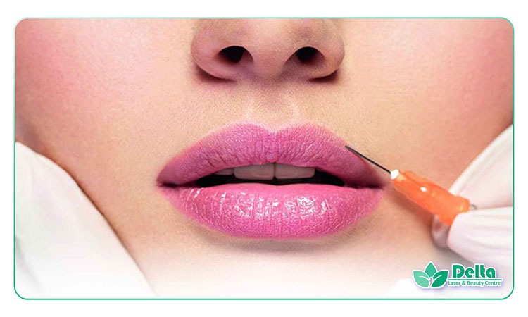 زمان مناسب استفاده از رژ لب بعد از تزریق ژل لب