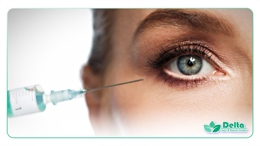 تصویری از زنی در حال تزریق فیلر زیر چشم