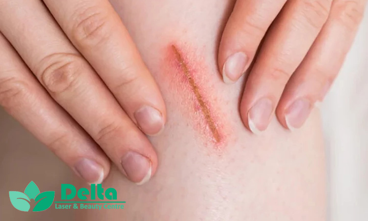 علت دیر خوب شدن زخم‌ها چیست؟