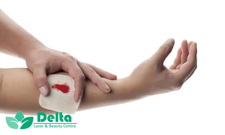 علت دیر خوب شدن زخم‌ها چیست؟