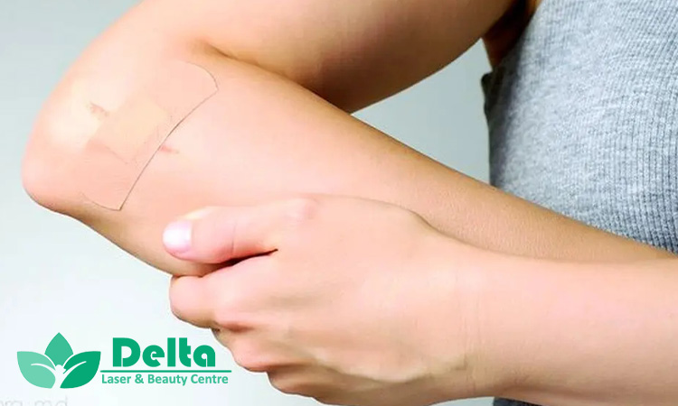 علت دیر خوب شدن زخم‌ها چیست؟