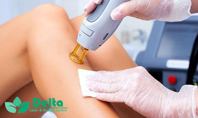 سن مناسب برای شروع لیزر موهای زائد چه موقع است ؟