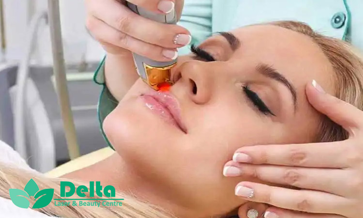 سن مناسب برای شروع لیزر موهای زائد چه موقع است ؟