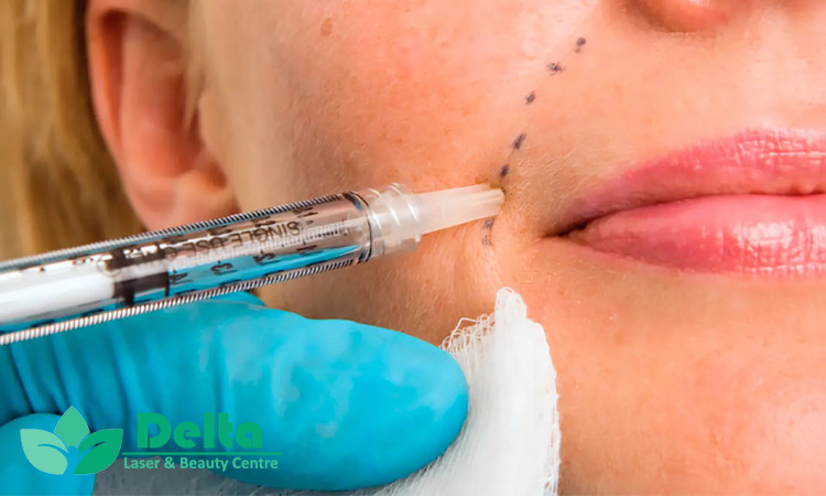 تفاوت تزریق سطحی و عمقی ژل در ناحیه خط خنده