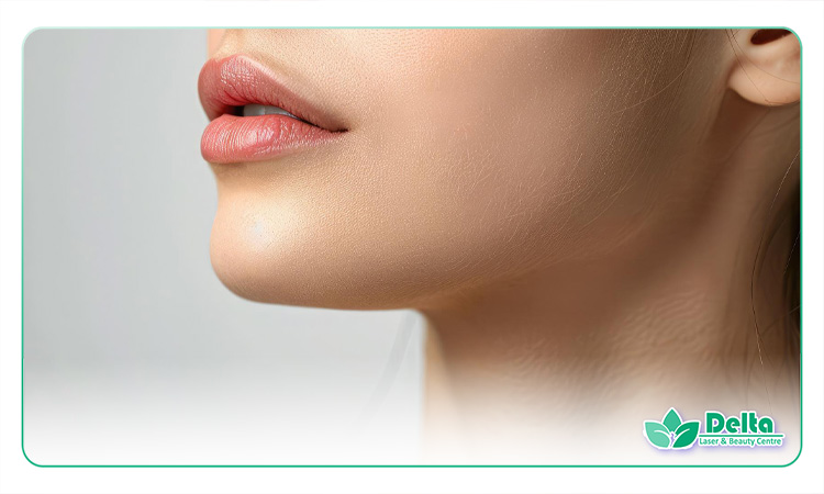 فیلر چانه برای زاویهسازی صورت