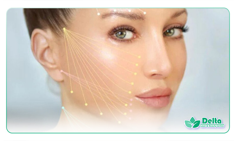 فیلر چانه برای زاویهسازی صورت