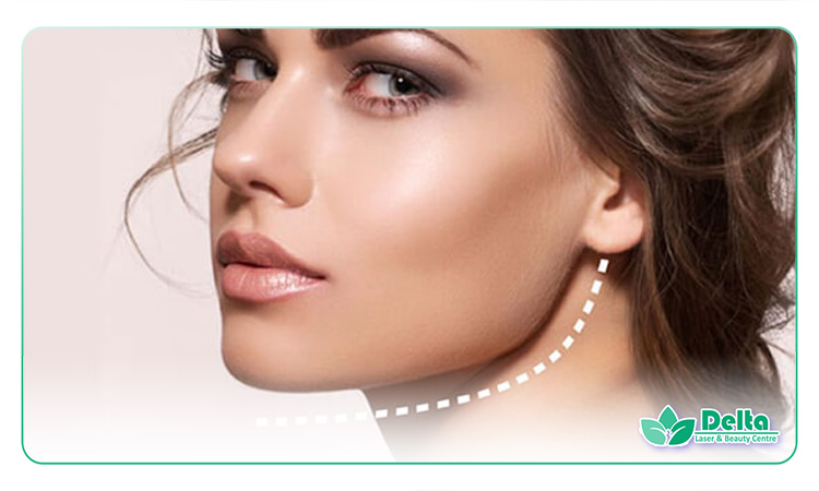 فیلر چانه برای زاویه‌سازی صورت