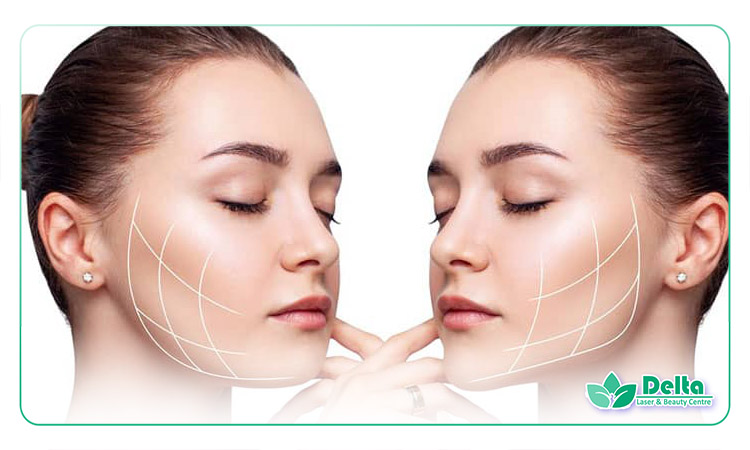 نکات مهم قبل و بعد از انجام کانتورینگ با تزریق فیلر