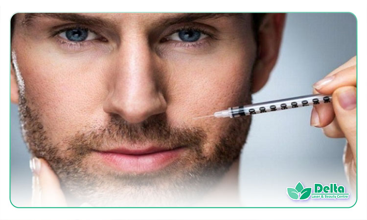 تزریق ژل خط خنده در مردان