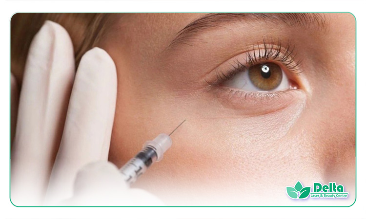 تفاوت فیلر گونه و چربی تزریقی