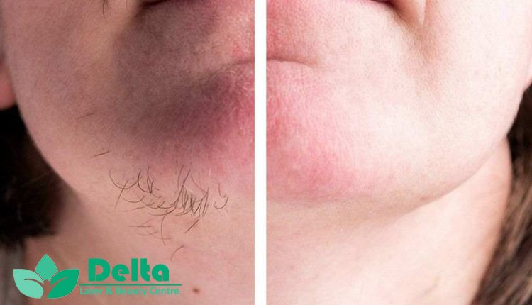 تاثیر تغذیه بر نتیجه لیزر موهای زائد